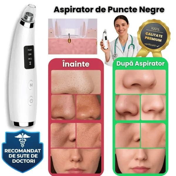 Aspirator de curatare faciala