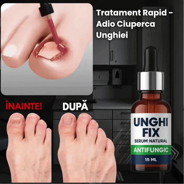 Tratament Ciuperca Și Unghii Incarnate